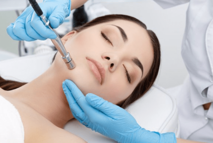 Microdermabrasion 